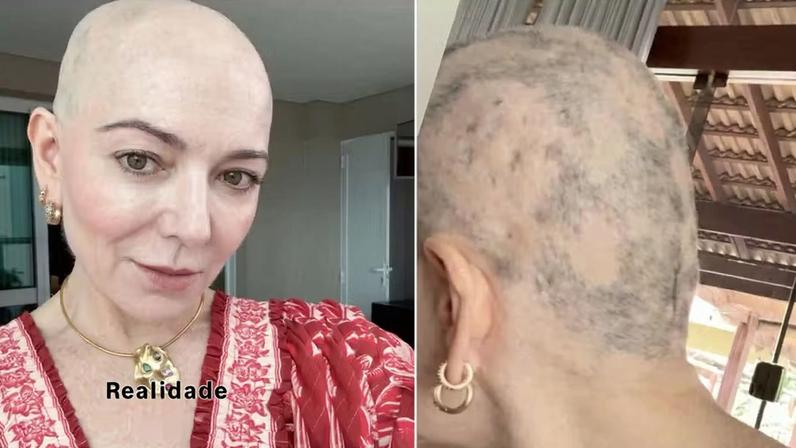 Mãe de Lucas Lucco mostra foto de perto e desabafa sobre falhas visíveis