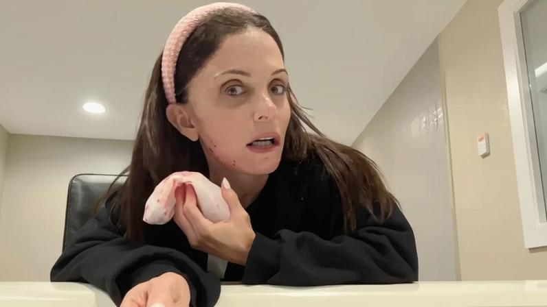 Bethenny Frankel was shaken up after she accidentally sliced her face open, as seen in grab above.