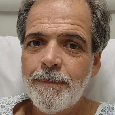 Claudio Cinti, recém-transplantado, vai a CTI; amigos pedem ajuda financeira