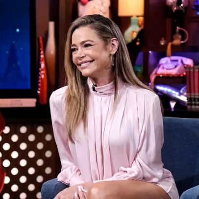 Denise Richards divulga fotos de antes e depois de lifting facial