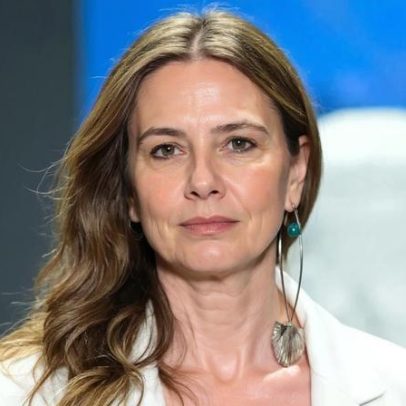 Luciana Gimenez afirma que envelhecer é natural e não precisa de colágeno