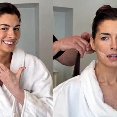 Anne Hathaway revela truque de beleza para Oscar que lembra facelift