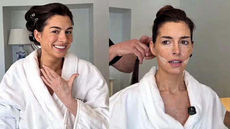 Anne Hathaway mostra truque de beleza usado no Oscar — Foto: Reprodução/Instagram