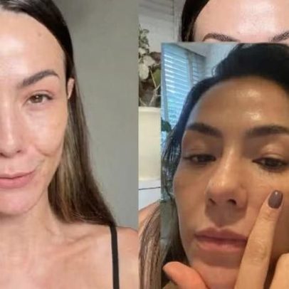 Influenciadora revela causa de crise alérgica: presente em quase todos os xampus