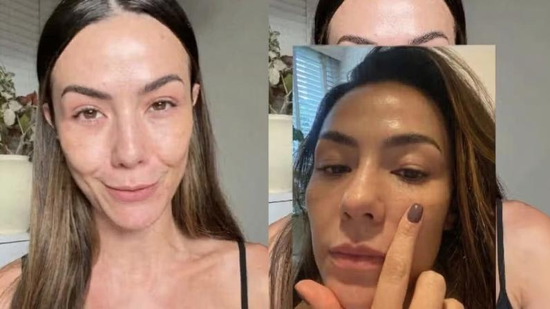 Influenciadora revela causa de crise alérgica: presente em quase todos os xampus