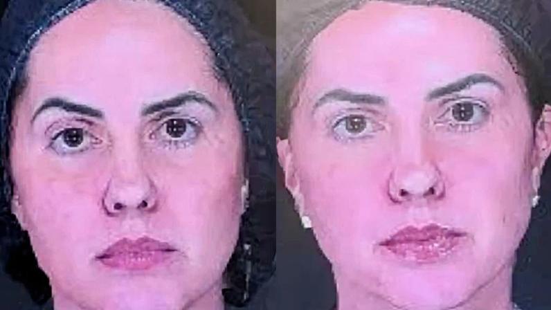 Antes e depois de Graciele Lacerda — Foto: Reprodução/Instagram