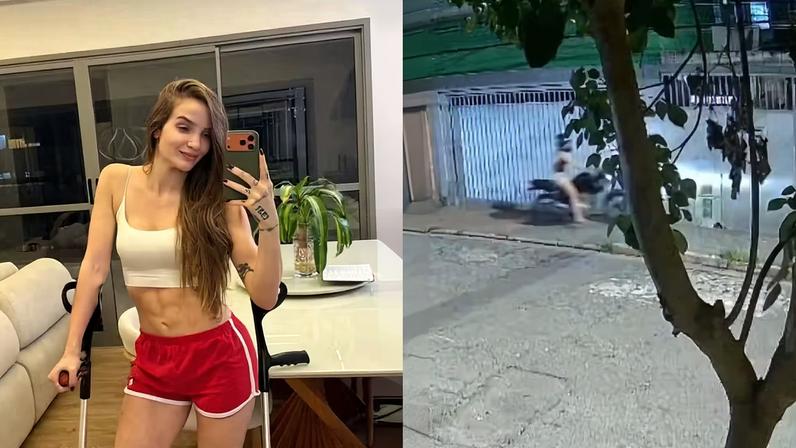 Anna Livya, ex-Chiquititas, mostra detalhes do acidente de moto — Foto: Reprodução/Instagram