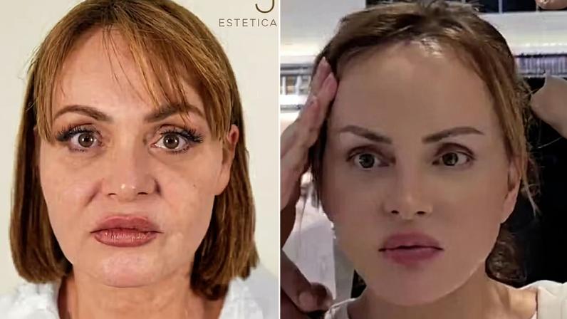 Gaby Spanic estreia com novo rosto após procedimentos, Paola renasceu
