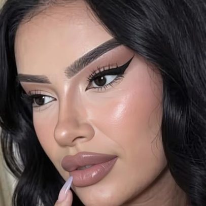 Influenciadora relata mudanças no rosto após procedimentos e três passaportes