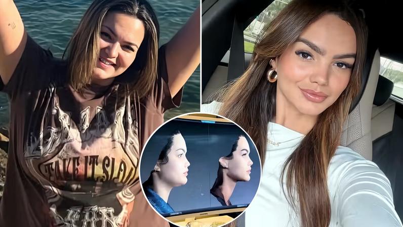 Com 26 kg a menos, filha de Kelly Key mostra antes e depois do rosto e revela como fez para não 'derreter' de flacidez