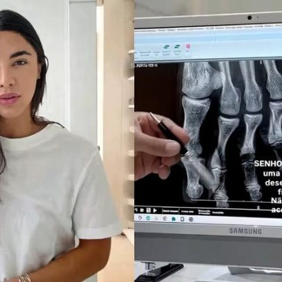 Gabriela Versiani sofre acidente doméstico após disenteria