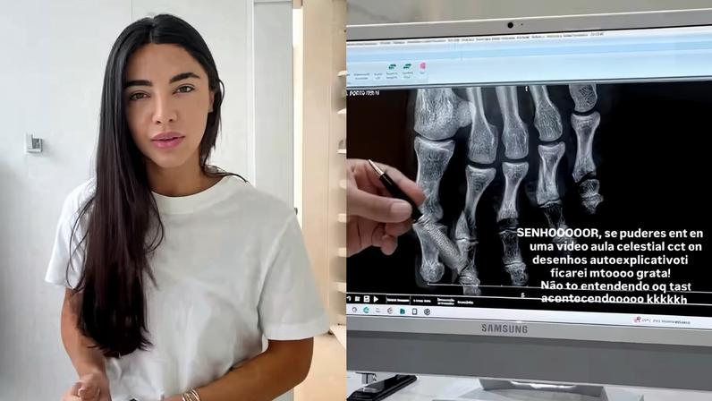 Gabriela Versiani enfrenta imprevistos, sofre acidente doméstico e pede: ‘Quem colocou olho gordo, tira agora’ — Foto: Reprodução/Instagram