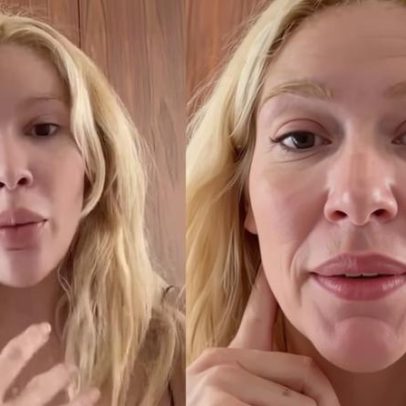 Karoline Lima surge com olhos inchados após choro; fãs ficam preocupados