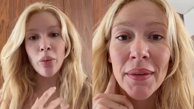 Karoline Lima aparece com olhos inchados após chorar muito e preocupa fãs: ‘Minha cara está terrível’ — Foto: Reprodução/Instagram