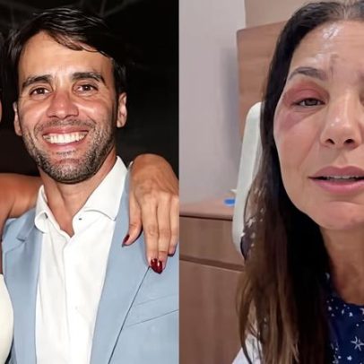 Daniel Cady comenta cirurgia de Ivete Sangalo e tranquiliza fãs