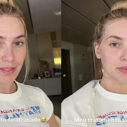 Virginia Fonseca relata atraso no tratamento de enxaqueca