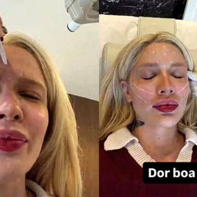 Karoline Lima retoca botox e aposta em fios de sustentação