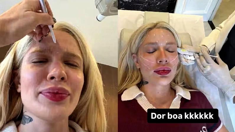 Karoline Lima retoca botox e aposta em fios de sustentação