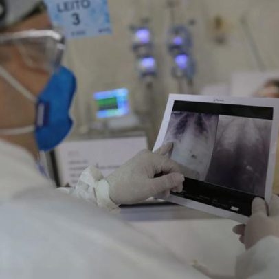 Bolsonaro é internado por broncopneumonia e passa por avaliação médica