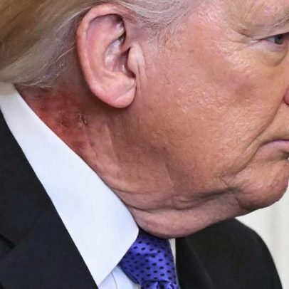 Pescoço de Trump parece precisar de erva verde