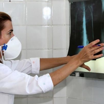 OMS recomenda testes rápidos de diagnóstico para erradicar a tuberculose