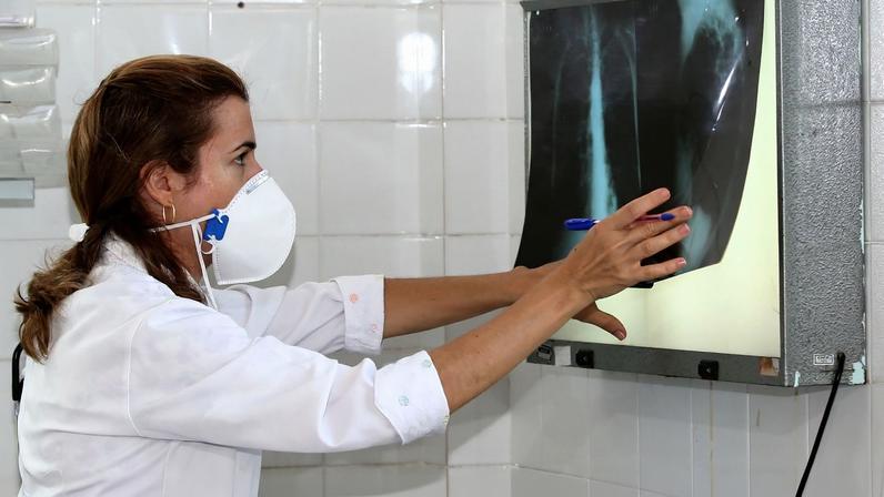 Tuberculose