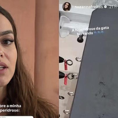 Suzanna Freitas detalha limitações da hiperidrose intensa