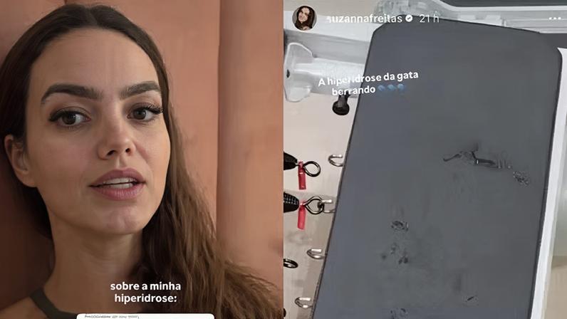 Suzanna Freitas fala sobre hiperidrose — Foto: Reprodução | Instagram