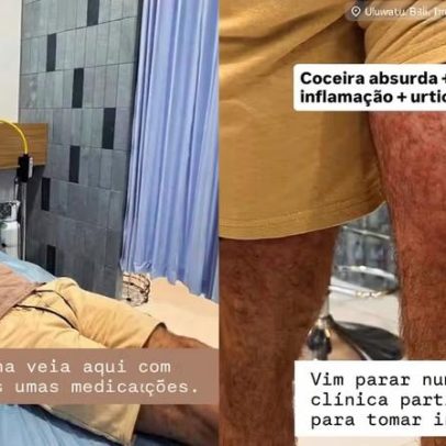 Lucas Malvacini é hospitalizado na Indonésia após ataque de ácaros