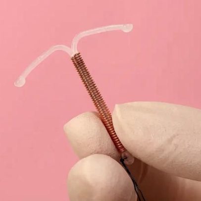 DIU hormonal aumenta risco de câncer de mama? O que se sabe