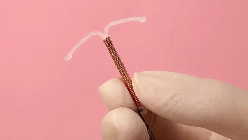 DIU hormonal aumenta risco de câncer de mama? O que se sabe