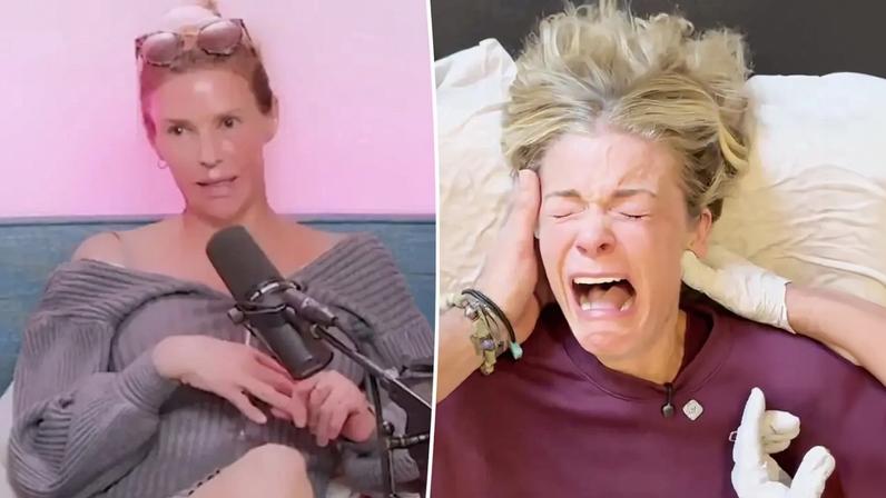 Brandi Glanville questiona LeAnn Rimes por vídeo de terapia de mandíbula dolorosa