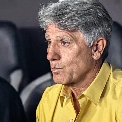 Renato Gaúcho reconhece erros do Vasco na derrota para o Botafogo