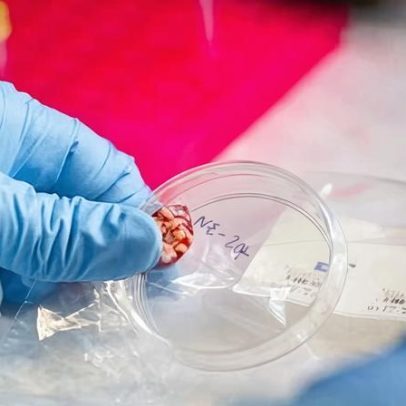 CDC interrompe testes de várias doenças infecciosas por falta de pessoal