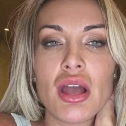 Andressa Urach relata saúde mental após surto e cinco dias acamada