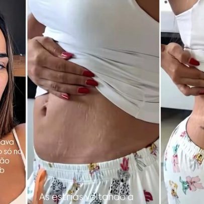 Grávida Tainá Militão mostra estrias na barriga e no peito em vídeo