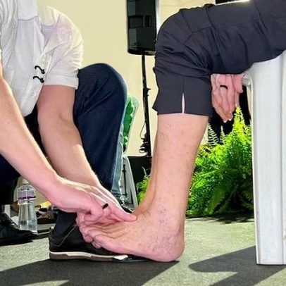 Ministério da Saúde lança campanha para prevenir amputações por diabetes