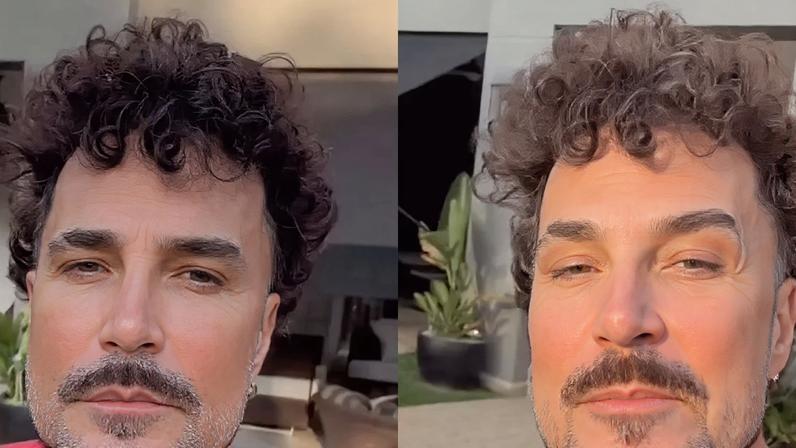 Latino surge irreconhecível em vídeo após procedimentos estéticos e antes e depois deixa web em choque. Veja!