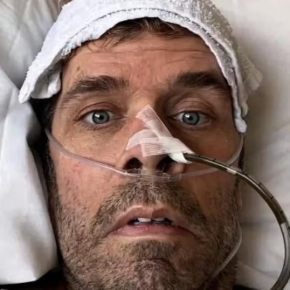 Perez Hilton passa por cirurgia de emergência e atualiza estado de saúde