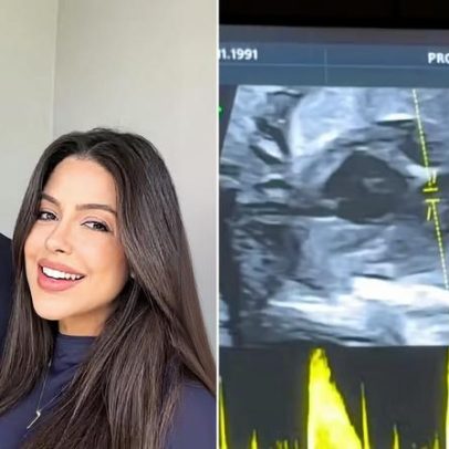 Laís Caldas, grávida, faz exame importante e comenta saúde do bebê