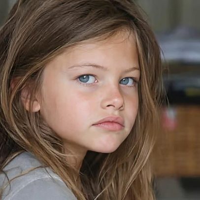 Menina considerada a mais bonita do mundo completa 25 anos e agradece pela vida