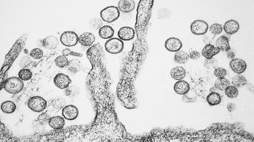 Fotografia do Micrografia eletrônica de transmissão do hantavírus Sin Nombre. Os hantavírus que causam a síndrome pulmonar por hantavírus (SPH) são transmitidos pelas fezes de roedores, especialmente o rato-do-campo.