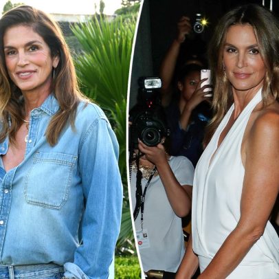 Cindy Crawford revela condição de saúde que enfrenta há 10 anos