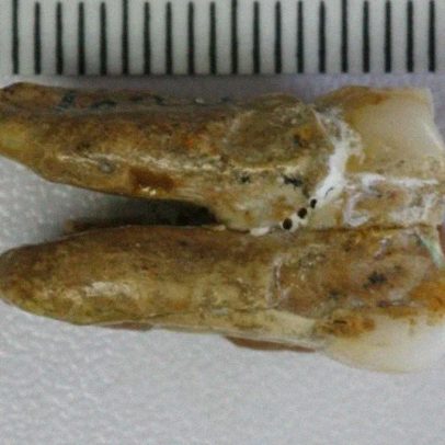 Dentes de 400 mil anos indicam cruzamento entre denisovanos e Homo erectus
