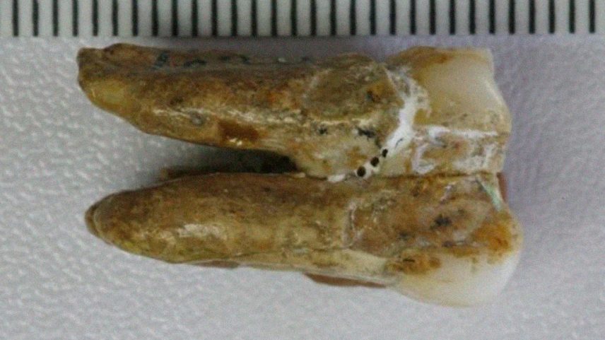 Dentes de 400 mil anos indicam cruzamento entre denisovanos e Homo erectus