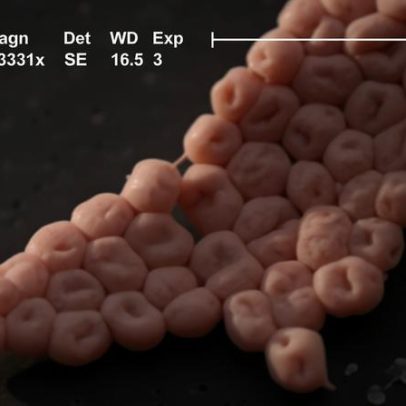Acinetobacter em Porto Alegre é uma das bactérias mais perigosas segundo estudo