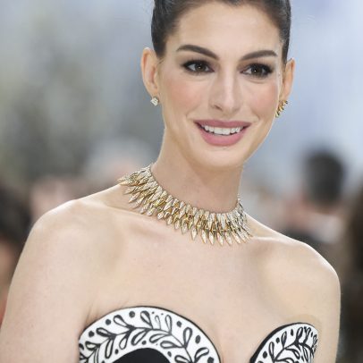 Condição médica secreta de uma década deixou Anne Hathaway quase cega na casa dos 30