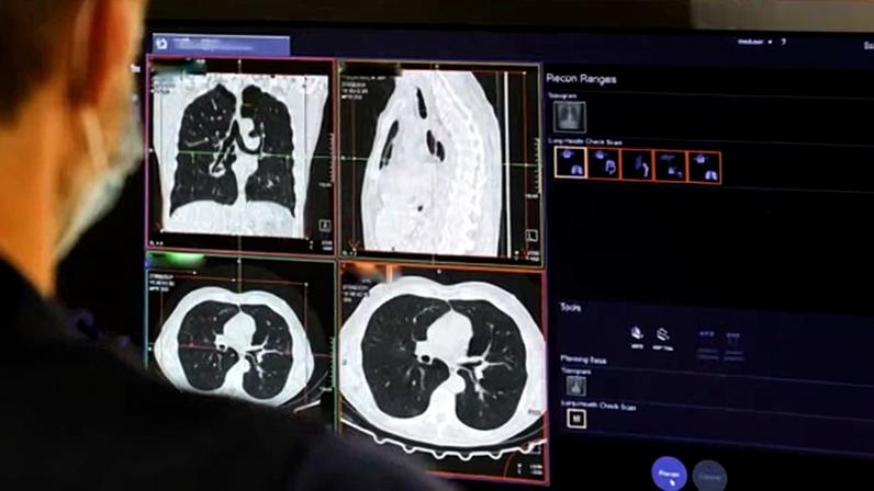 Most bosses of NHS radiology departments said the outsourced reports needed to be double-checked by NHS specialists.