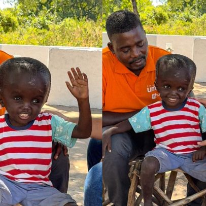 Menino africano com deficiência congênita fala de fé e diz que vai ao céu