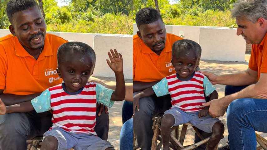Menino africano com deficiência congênita fala de fé e diz que vai ao céu
